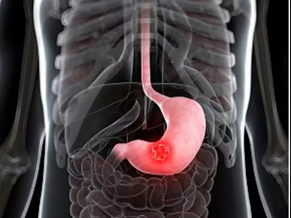 bevictor伟德官网 - 韦德官方网站